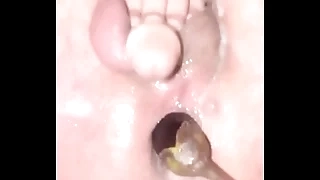 Gay anal eggplant
